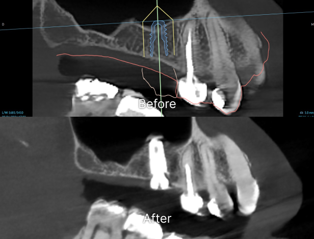 Case 1